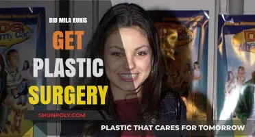Mila Kunis Plastic Surgery: Fact-Checking the Transformation Rumors