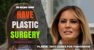 Melania Trump's Transformation: Plastic Surgery Speculations and Facts Revealed