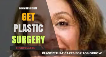 Did Miles Fisher Undergo Plastic Surgery? Uncovering the Truth