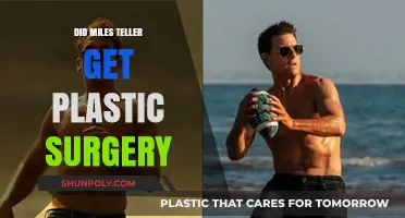 Miles Teller's Transformation: Plastic Surgery Rumors Explored and Debunked