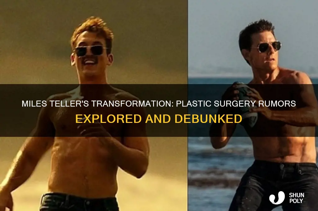 did miles teller get plastic surgery