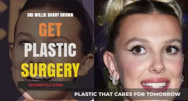 Millie Bobby Brown Plastic Surgery Rumors: Fact or Fiction?