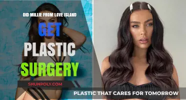 Millie Love Island Plastic Surgery: Fact-Checking Transformation Rumors