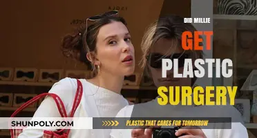 Millie's Transformation: Plastic Surgery Rumors and the Truth Behind Them