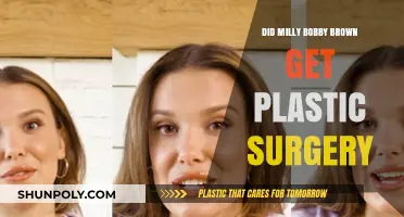 Milly Bobby Brown Plastic Surgery Rumors: Fact or Fiction?