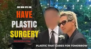 Min Hyo Rin's Transformation: Plastic Surgery Speculations and Truths