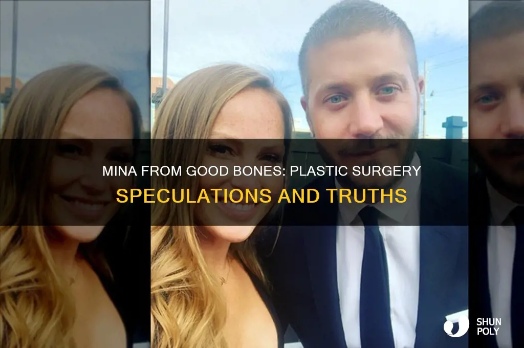 did mina from good bones have plastic surgery