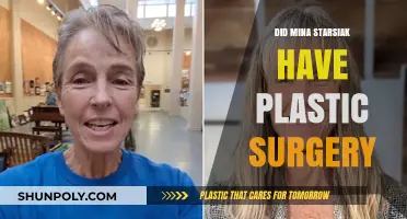 Mina Starsiak's Transformation: Plastic Surgery Rumors Explored and Debunked