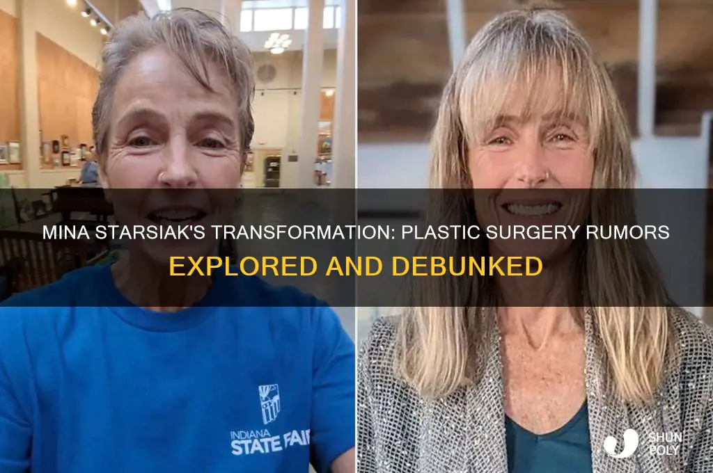 did mina starsiak have plastic surgery