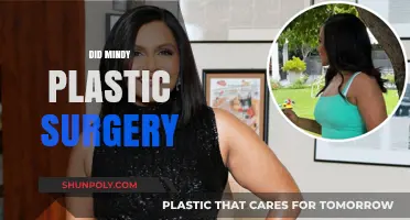 Did Mindy Kaling Undergo Plastic Surgery? Unraveling the Truth