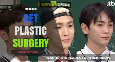 Minho's Transformation: Plastic Surgery Rumors and the Truth Behind Them