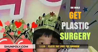 Minji's Transformation: Uncovering the Truth About Plastic Surgery Rumors