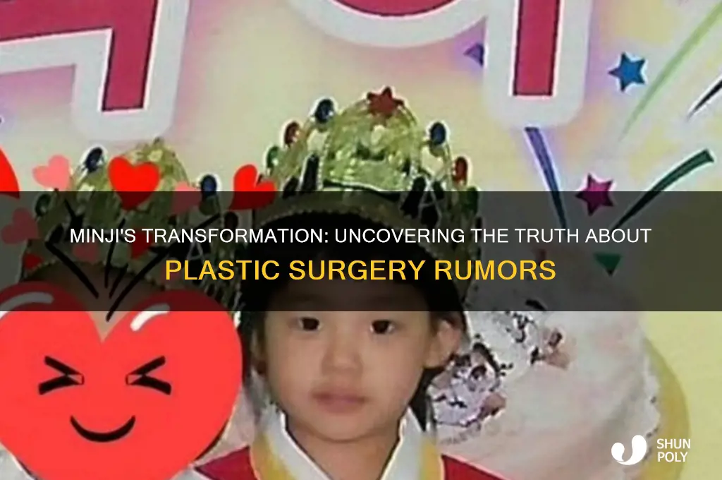 did minji get plastic surgery