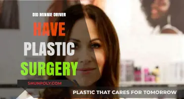 Minnie Driver's Transformation: Plastic Surgery Speculations and Truths Revealed