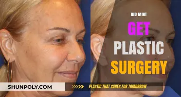 Did Mint Undergo Plastic Surgery? Unraveling the Truth Behind the Rumors