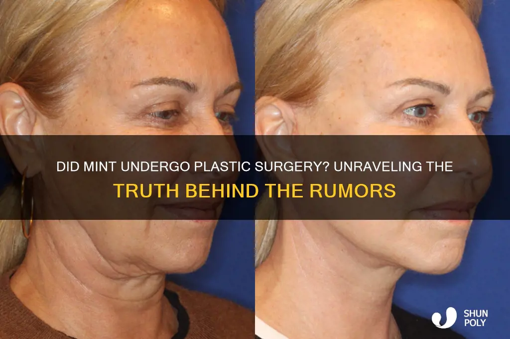 did mint get plastic surgery