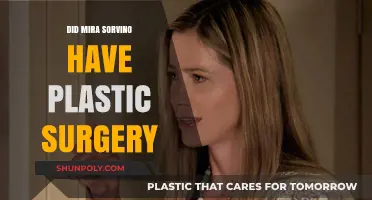 Mira Sorvino Plastic Surgery: Fact-Checking the Rumors and Speculations