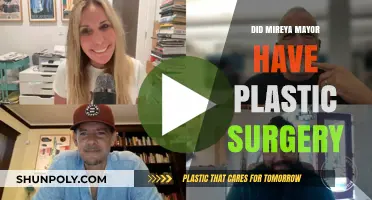 Mireya Mayor Plastic Surgery: Fact-Checking the Rumors and Speculations