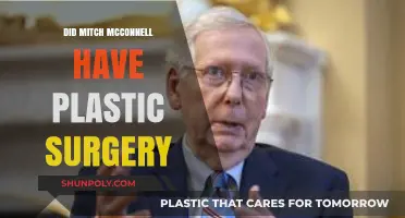 Mitch McConnell's Appearance: Plastic Surgery Speculations and Facts