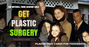 Did Mitchell from Gilmore Girls Undergo Plastic Surgery? The Truth