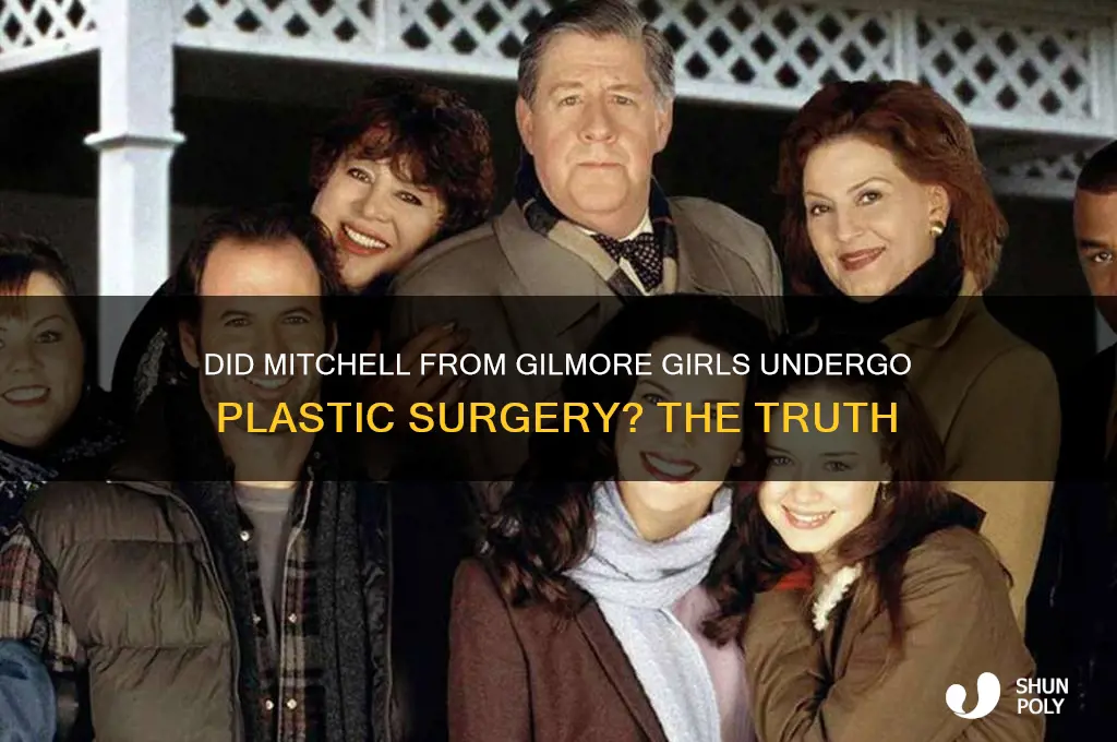 did mitchell from gilmore girls get plastic surgery