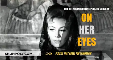 Mitzi Gaynor's Eye Transformation: Plastic Surgery Speculations Explored