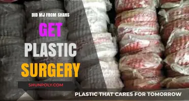 MJ from Shahs of Sunset: Plastic Surgery Transformation Explored