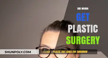 Moira's Transformation: Plastic Surgery Rumors and the Truth Revealed