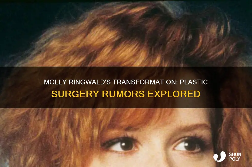 did molly ringwald get plastic surgery