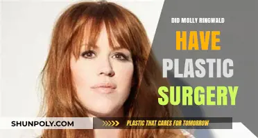 Molly Ringwald Plastic Surgery: Fact-Checking the Rumors and Speculations