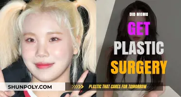 Did Momo Undergo Plastic Surgery? Unraveling the Truth Behind Her Look