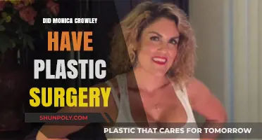 Monica Crowley's Transformation: Plastic Surgery Speculations and Truths Revealed