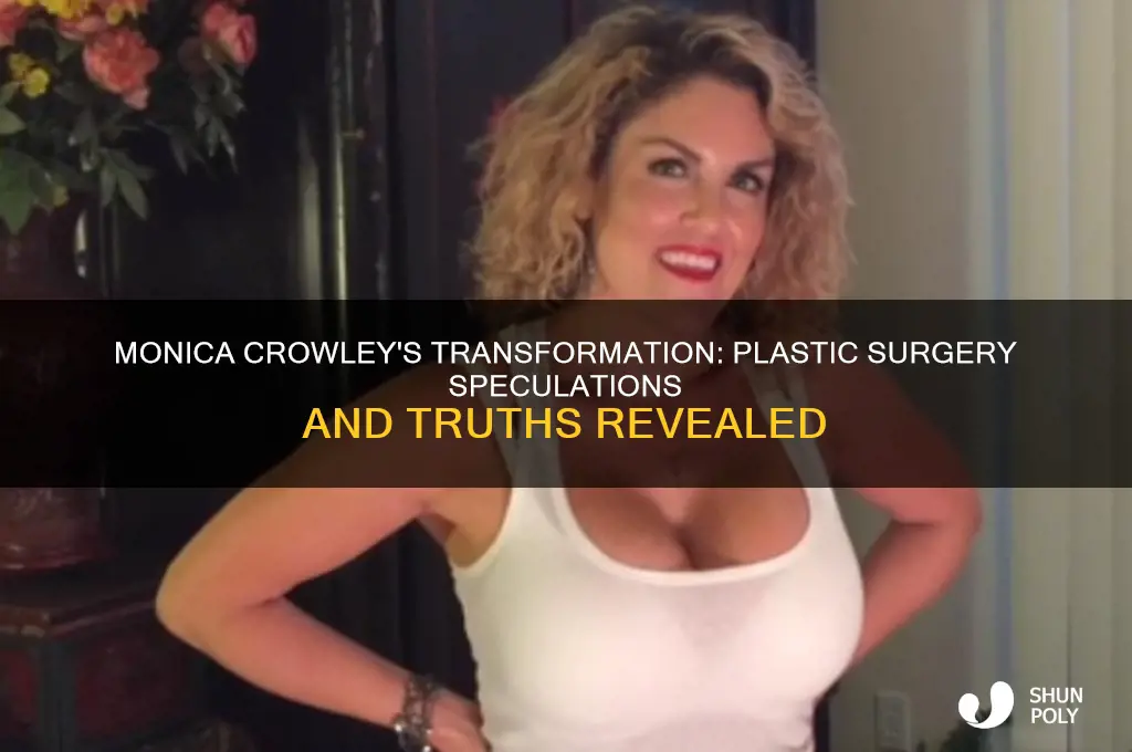 did monica crowley have plastic surgery