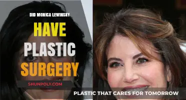 Monica Lewinsky's Transformation: Plastic Surgery Speculations and Truths Revealed