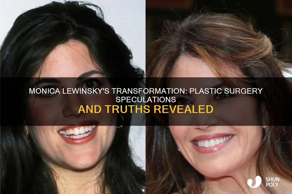 did monica lewinsky have plastic surgery