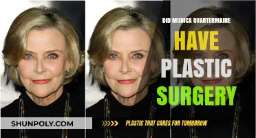 Monica Quartermaine's Transformation: Plastic Surgery Speculations and Truths