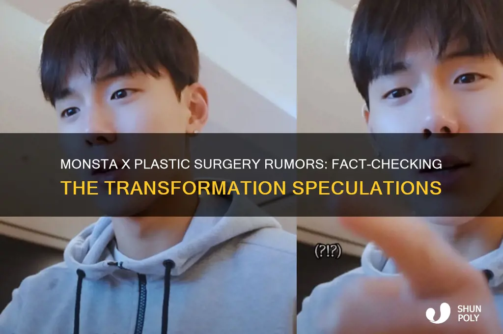 did monsta x get plastic surgery