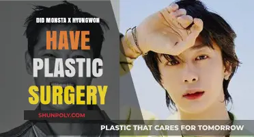 Monsta X Hyungwon's Transformation: Plastic Surgery Rumors Explored
