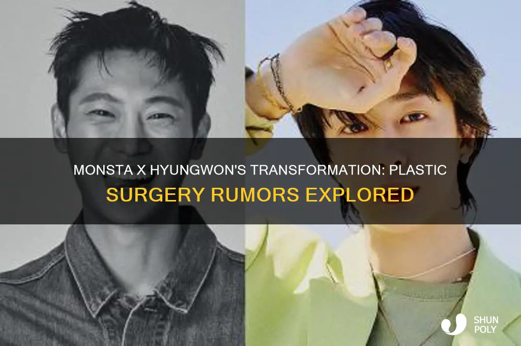 did monsta x hyungwon have plastic surgery