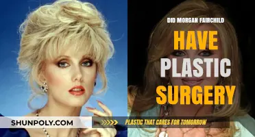 Morgan Fairchild's Transformation: Plastic Surgery Speculations and Truths