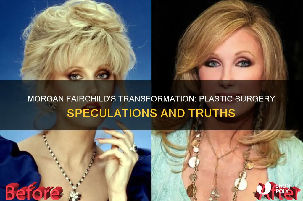 did morgan fairchild have plastic surgery