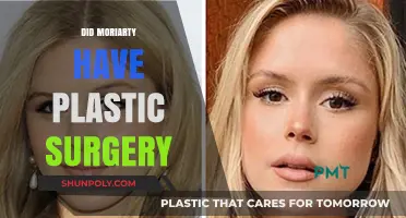 Moriarty's Transformation: Unveiling the Plastic Surgery Speculations and Truths