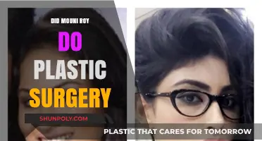 Mouni Roy's Transformation: Plastic Surgery Rumors Explored and Debunked