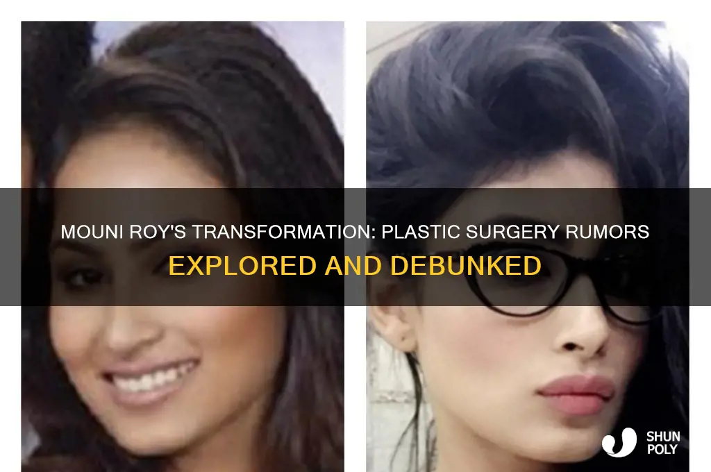 did mouni roy do plastic surgery