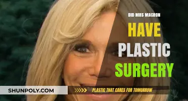 Did Mrs. Macron Undergo Plastic Surgery? Unveiling the Truth