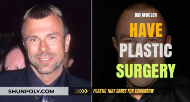 Did Mugler Undergo Plastic Surgery? Unveiling the Truth Behind the Speculations