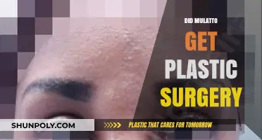 Mulatto's Transformation: Plastic Surgery Rumors and the Truth Behind Them