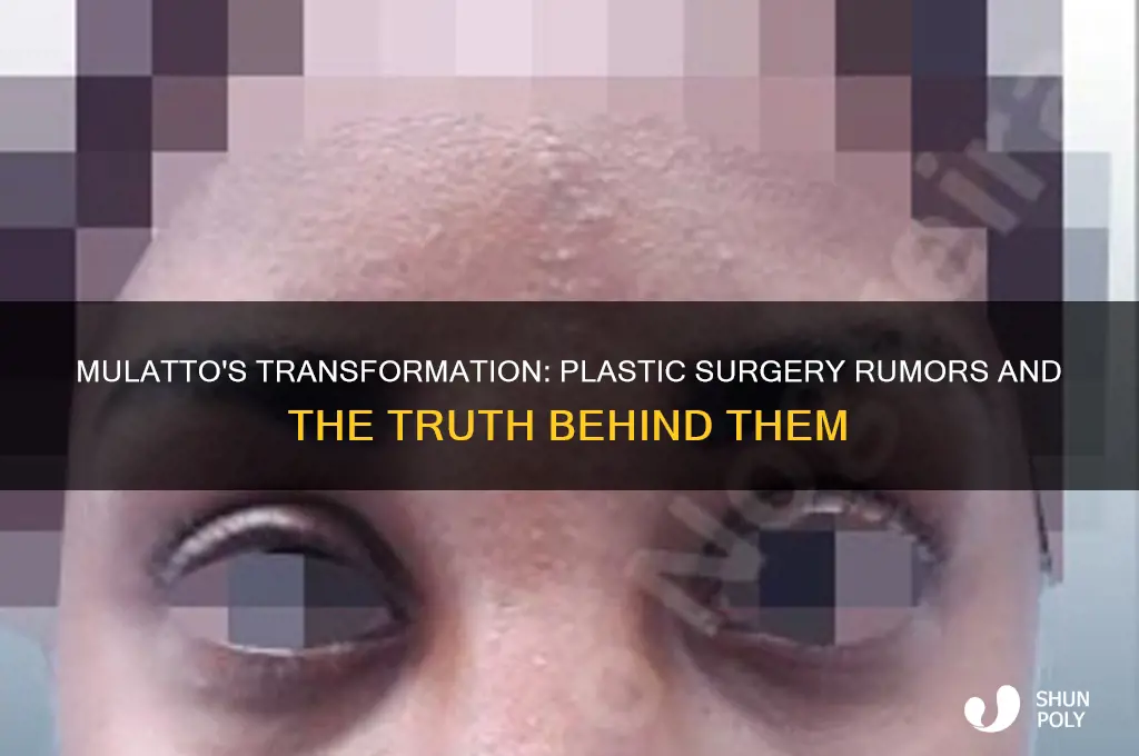 did mulatto get plastic surgery