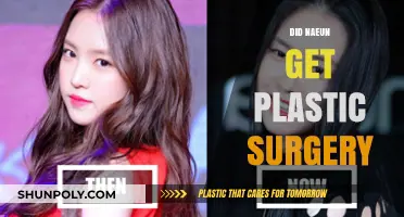Did Naeun Undergo Plastic Surgery? Unveiling the Truth Behind the Rumors