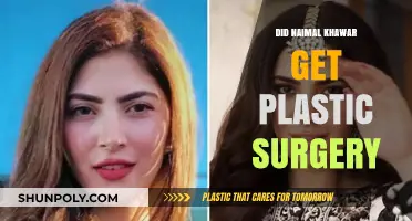 Naimal Khawar's Transformation: Plastic Surgery Rumors Explored
